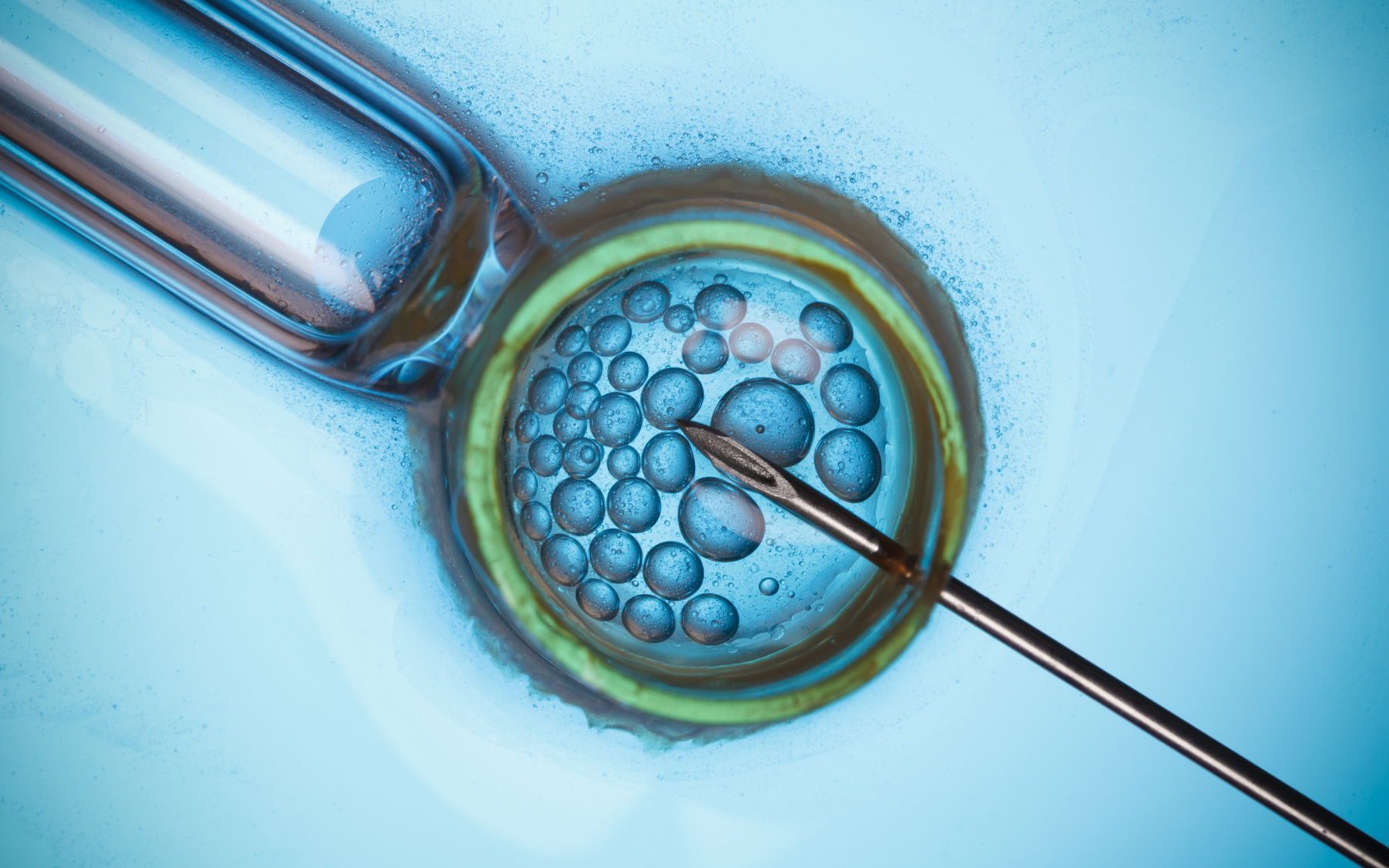 Micro-dissection sperm retrieval
