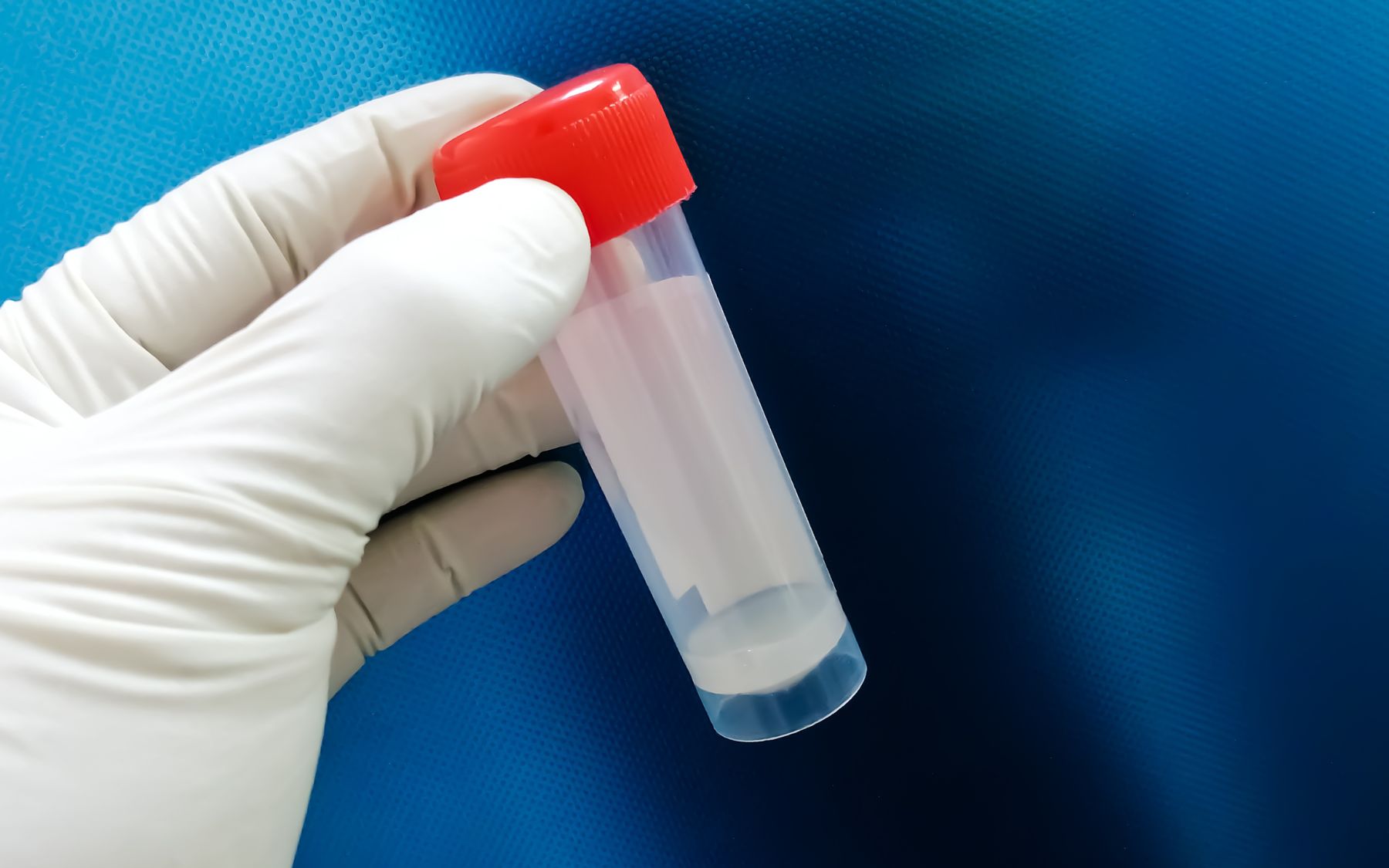 The role of sperm testing - London Andrology - Male Fertility