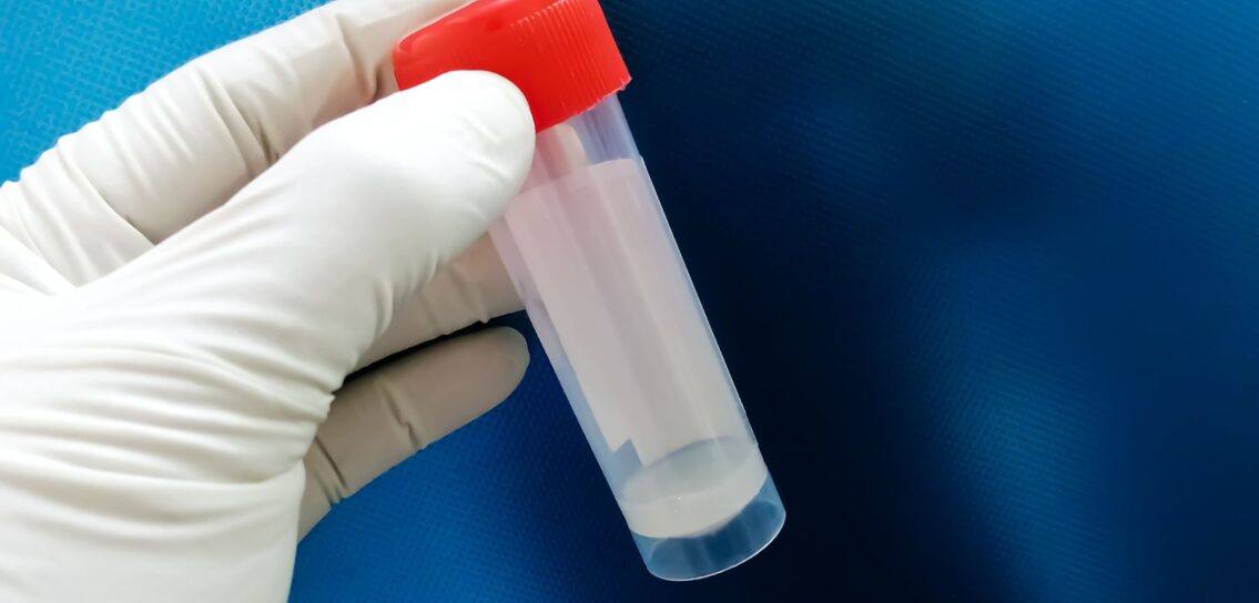 The role of sperm testing - London Andrology - Male Fertility