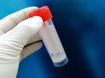 The role of sperm testing - London Andrology - Male Fertility